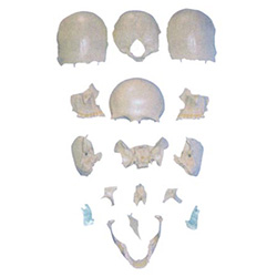 LM1018-1部分颅骨散骨模型